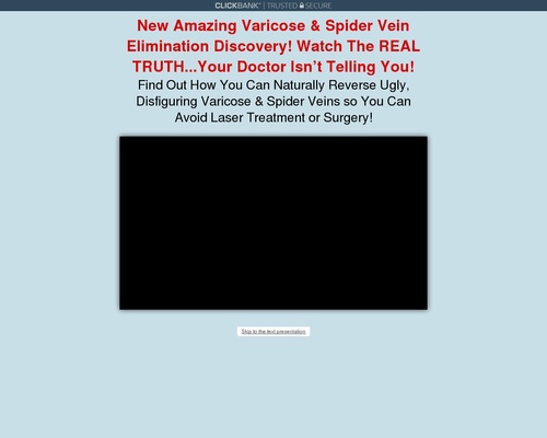 chronic vein problems - Varicose Veins Natural Treatment | Varicose Veins Home Treatment Program