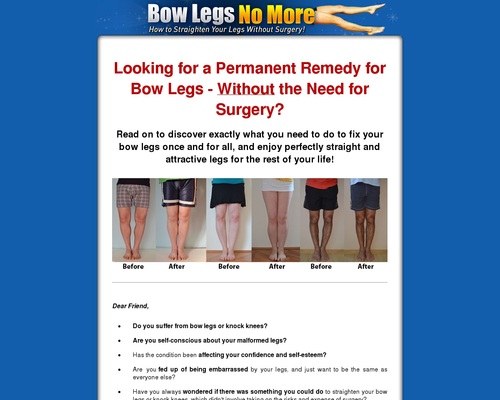 bow legs - Bow Legs No More - How To Straighten Your Legs Without Surgery!